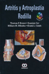 ARTRITIS Y ARTROPLASTIA DE RODILLA | 9789587550559 | Portada