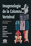 IMAGENOLOGIA DE LA COLUMNA VERTEBRAL | 9789588760438 | Portada