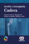 ARTRITIS Y ARTROPLASTIA: CADERA | 9789588760193 | Portada