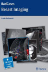 BREAST IMAGING (RADCASES SERIES) + 150 MORE CASES ONLINE | 9781604061918 | Portada