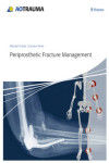 PERIPROSTHETIC FRACTURE MANAGEMENT | 9783131715111 | Portada