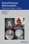 NORMAL PRESSURE HYDROCEPHALUS | 9783131646019 | Portada