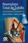 REEMPLAZO TOTAL DE TOBILLO PROCEDIMIENTOS QUIRURGICOS | 9789585902046 | Portada