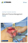 MANUAL OF FRACTURE MANAGEMENT. HAND | 9783132215818 | Portada