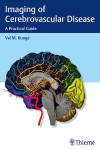 IMAGING OF CEREBROVASCULAR DISEASE. A PRACTICAL GUIDE | 9781626232488 | Portada