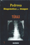 Diagnóstico por Imagen, Vol. 1: Tórax | 9788471015938 | Portada