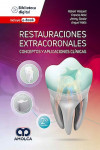 Restauraciones Extracoronales. Conceptos y Aplicaciones Clínicas | 9786287528420 | Portada