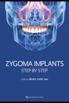 Zygoma Implants Step by Step | 9781647241575 | Portada