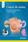 Cáncer de mama. Bases clínico-moleculares y manejo integral + ebook | 9786078546893 | Portada