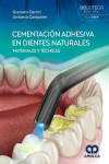 Cementación Adhesiva en Dientes Naturales. Materiales y Técnicas | 9786287528864 | Portada