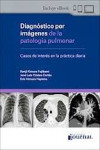 Diagnóstico por Imágenes de la Patología Pulmonar. Casos de Interés en la Práctica Diaria | 9789878452746 | Portada