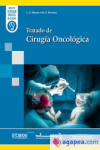 Tratado de Cirugía Oncológica + ebook | 9788411061209 | Portada