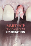 IMMEDIATE DENTOALVEOLAR RESTORATION. Immediately Loaded Implants in Compromised Sockets | 9781647241711 | Portada