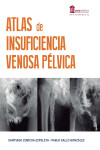 Atlas de Insuficiencia Venosa Pélvica | 9788478857364 | Portada